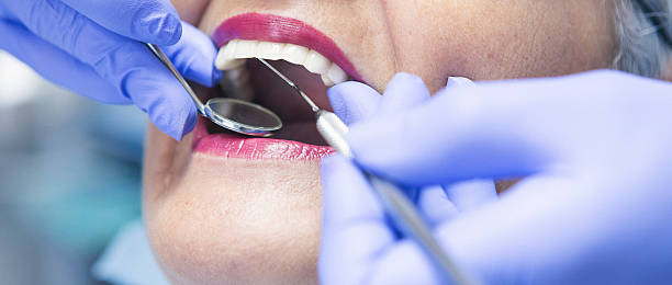 Best Chipped Tooth Repair Near Me  in Clifton Heights, PA